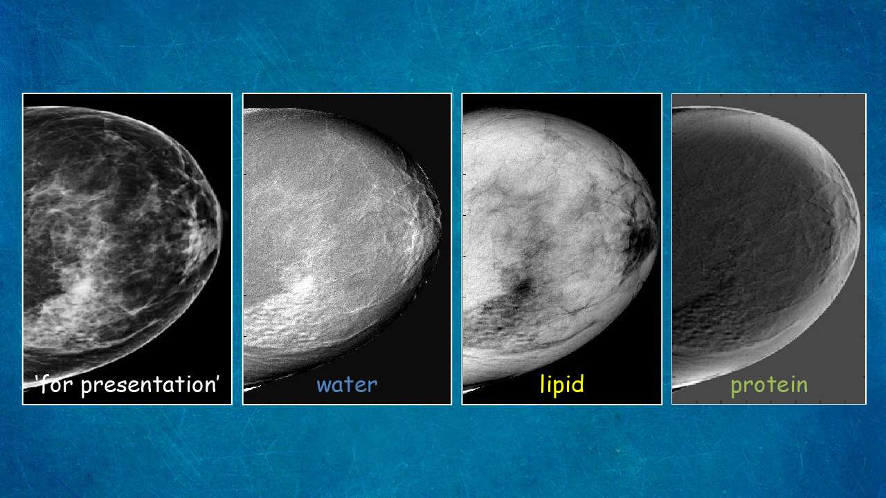 Three-compartment breast imaging study illustration