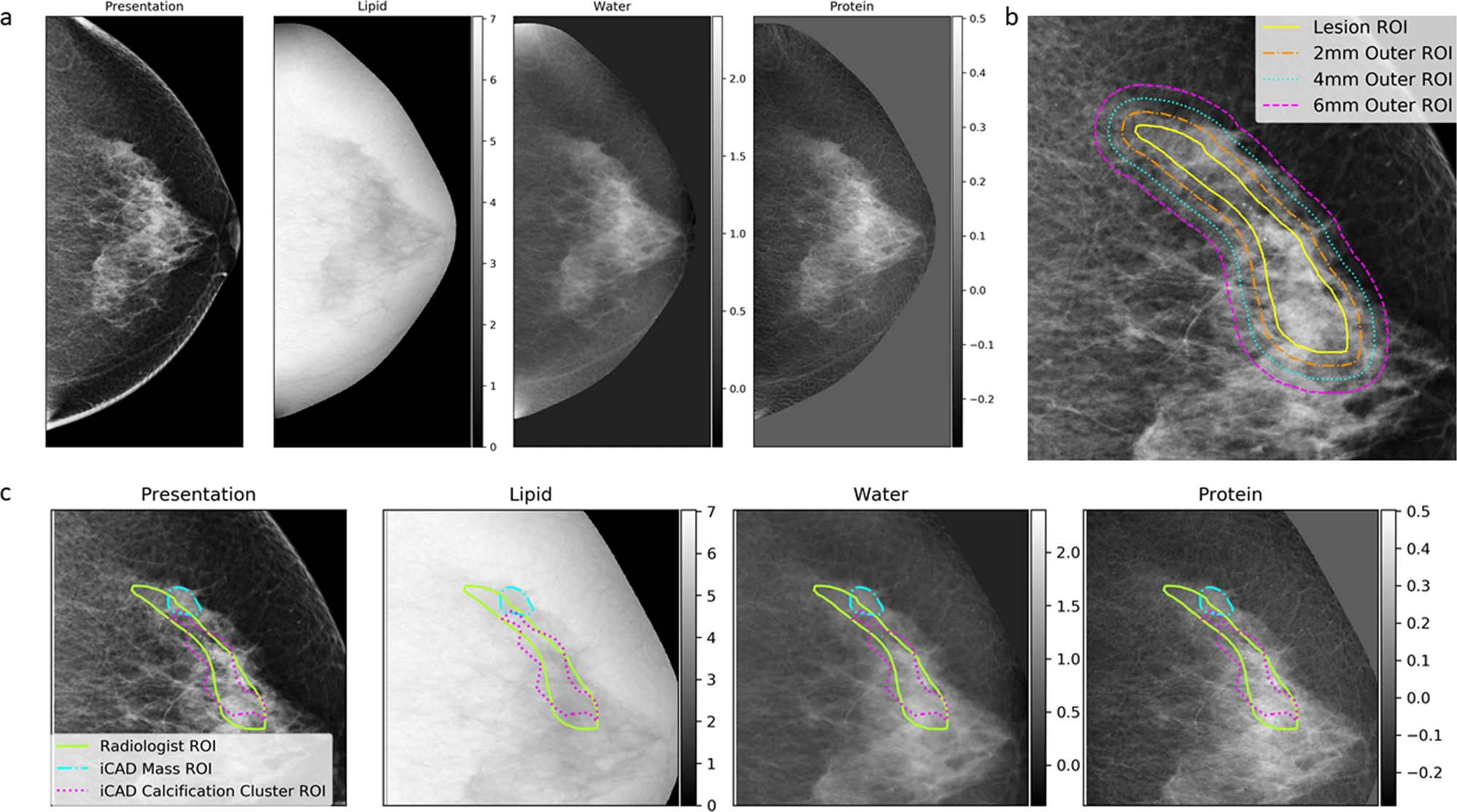 ROC curves showing improved cancer detection performance when adding 3CB compositional information to CAD